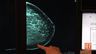3D Mammography Aids In The Fight Against Breast Cancer