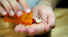 How To Use Statins To Manage Cholesterol