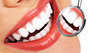 How To Remove Stains - Teeth Whitening Tips - Howdini